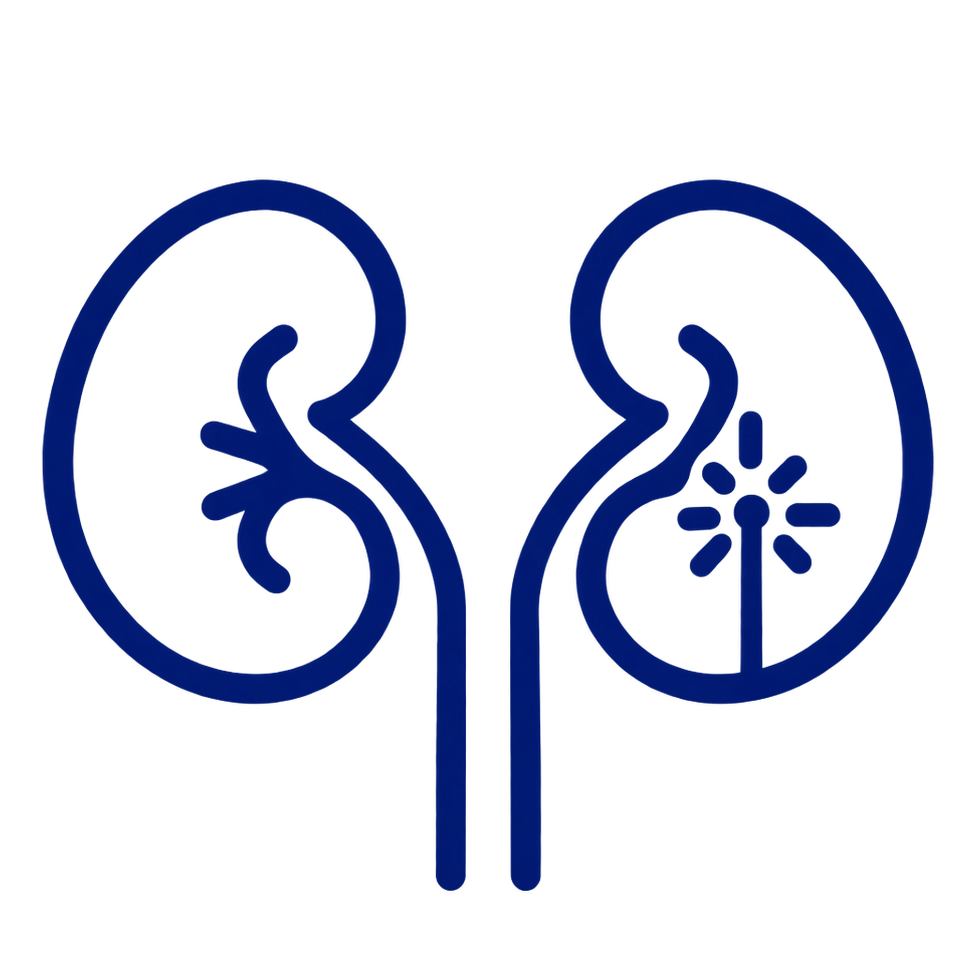 Laser surgery for kidney stones
